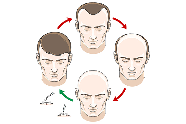 hair-cycle