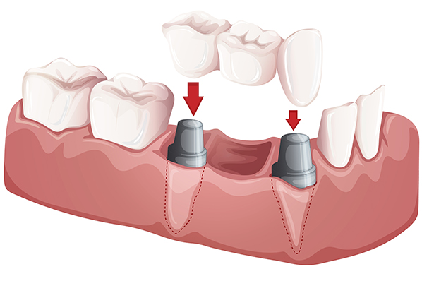 New Dental Technology Now Available to Public